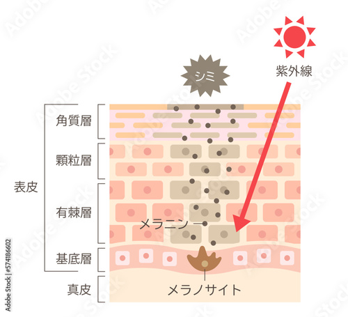 シミのしくみ　紫外線と肌　断面図