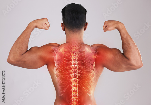 Man, x ray spine and studio with pain, back or bodybuilder for muscle, bicep arms or development by background. Young model, fitness or chiropractic overlay for pain, injury or strong core for body