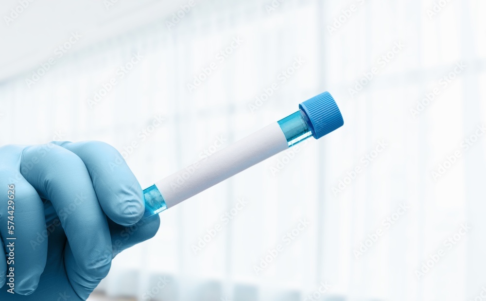 Blood sample tubes in hand, medical concept Blood sample tubes in hand, medical concept