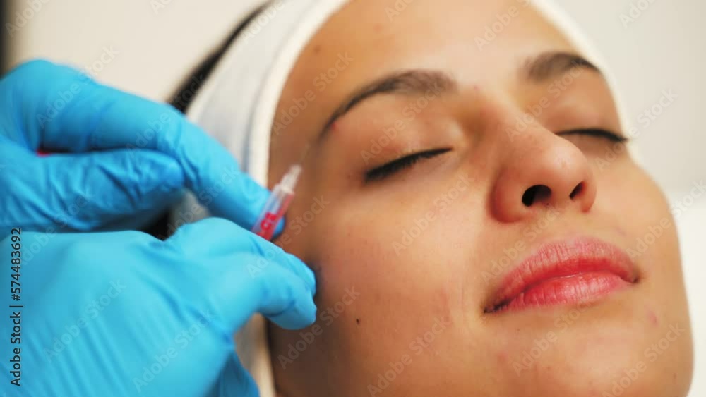 Woman getting botox injection at clinic doctor holding syringe near her eyebrows. High quality 4k footage Woman getting botox injection at clinic doctor holding syringe near her eyebrows. High quality 4k footage