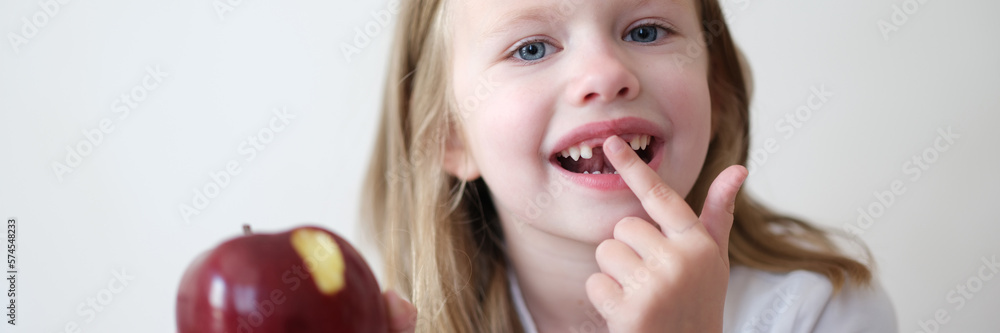 Portrait of smiling cute girl without teeth with red bitten apple in hand Portrait of smiling cute girl without teeth with red bitten apple in hand
