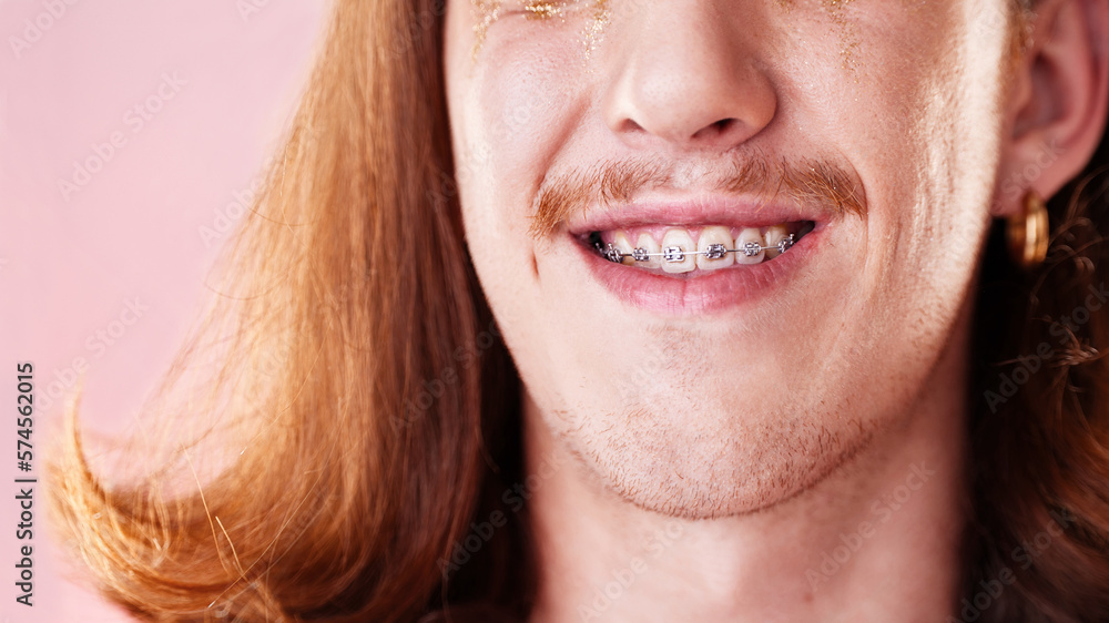 Face, teeth and dental with man in braces, orthodontics and beauty with cosmetics and healthcare on pink background. Young, gen z and fashion, oral care and mouth zoom, smile and health insurance Face, teeth and dental with man in braces, orthodontics and beauty with cosmetics and healthcare on pink background. Young, gen z and fashion, oral care and mouth zoom, smile and health insurance