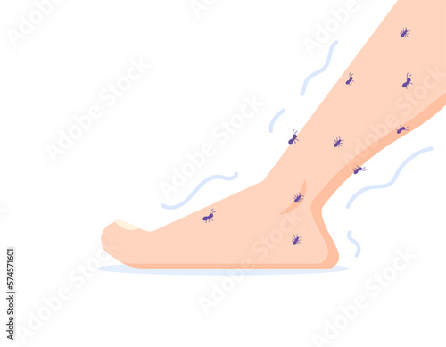 illustration of a foot that is swarmed by ants. tingling feet. health problems. illustration concept design. design elements photo