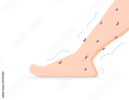 illustration of a foot that is swarmed by ants. tingling feet. health problems. illustration concept design. design elements