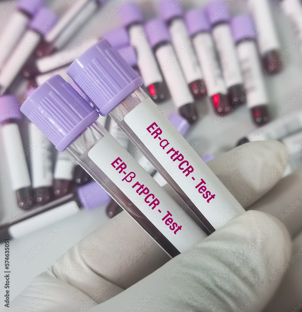 Blood sample for ERα (Estrogen receptor α) and ERβ (Estrogen Receptors β)  rtPCR testing, It's nuclear transcription factors that are involved in regulation of complex physiological processes.