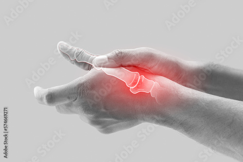 Arthritis of the finger and thumb joint. photo