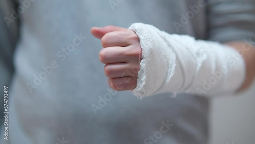 The broken arm of a man in gaps. Plaster cast on a broken arm close-up.