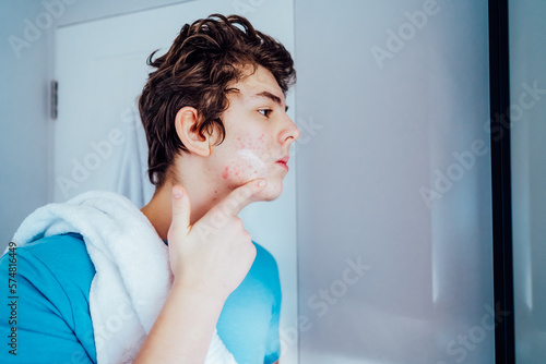 Concentrated caucasian teenage boy with acne problem take care his face skin at home. He looking in mirror and aplying cream on the face in bathroom. Teenager skin care every day treatment process photo