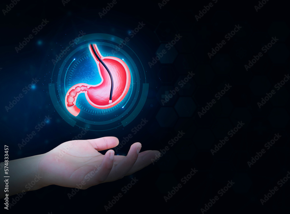 Endoscopic biopsy, esophagogastroduodenoscopy, EGD. Human stomach