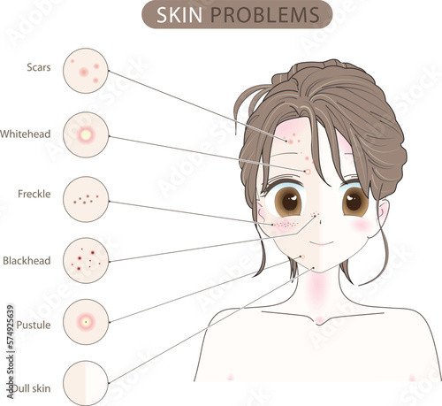 Troubled woman and set of most common female facial skin problems needs to care about: acne ,Freckle and dull skin.Showing problematic and non-problematic face parts as a cute girl cartoon character.