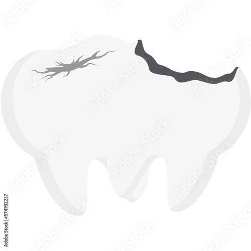 Double Tooth Broken Cavity Cracked Teeth
