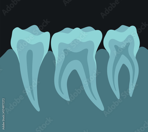 X ray image of teeth dental equipment medical surgery radiogram photo vector flat illustration photo