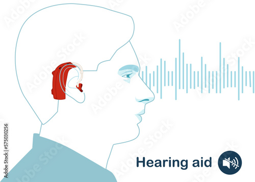 Head with a hearing aid in the ear. For the hearing impaired and the deaf, with sound wave. Modern vector illustration in flat style