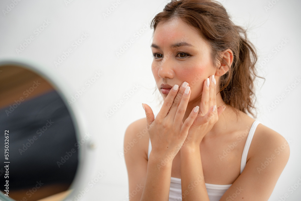 Young woman are worried about faces Dermatology and allergic to steroids in cosmetics. sensitive skin, red face from sunburn, acne, allergic to chemicals, rash on face. skin problems and beauty Young woman are worried about faces Dermatology and allergic to steroids in cosmetics. sensitive skin, red face from sunburn, acne, allergic to chemicals, rash on face. skin problems and beauty
