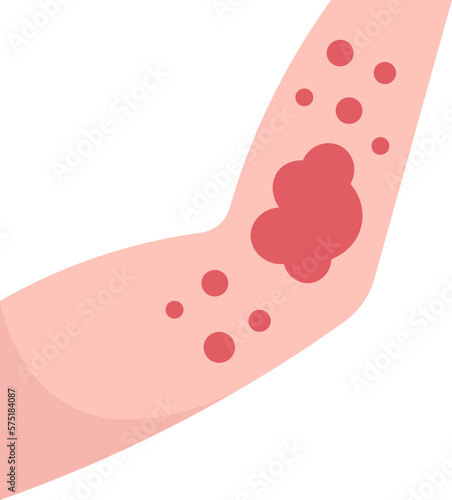 rash  icon