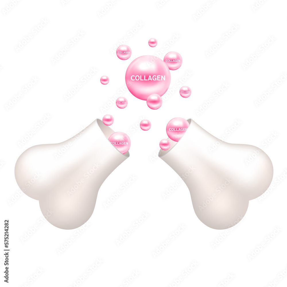 Collagen float out of the bone capsule. Help heal arthritis knee joint