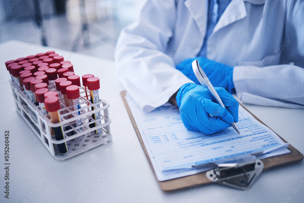 Blood test, medicine documents and hands in laboratory for healthcare ...