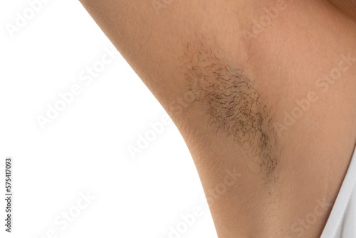 Tableau sur toile hairy female armpit, isolated on white background, close-up, unshaven, a lot of