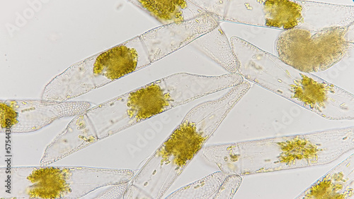 Marine diatom called Isthmia. Lugol preserved sample. Marine phytoplankton. 400x magnification with selective focus photo