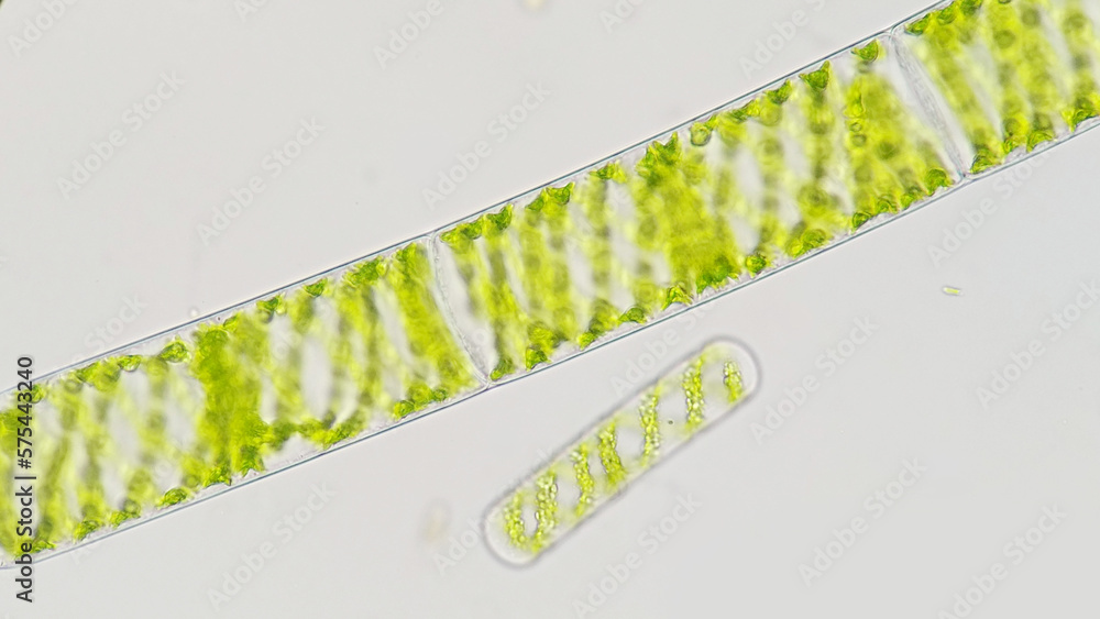 Spirogyra, a filamentous freshwater green algae with spiral arrangement