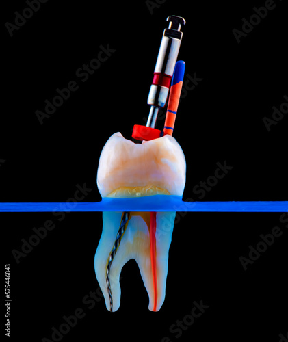 Fotografie tooth slice macro capture during root canal treatment