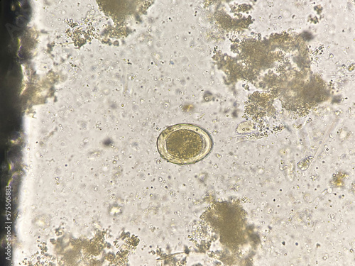 Ascaris lumbricoides  egg human parasite. photo