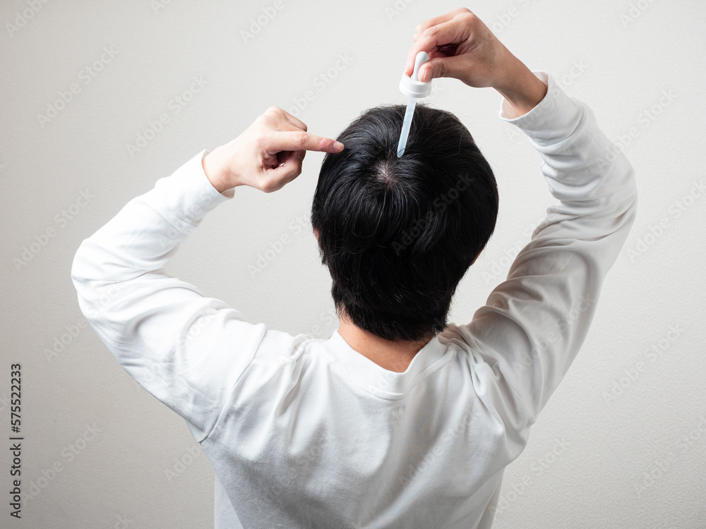 Naklejka premium 育毛剤を塗る男性 後頭部 髪の毛