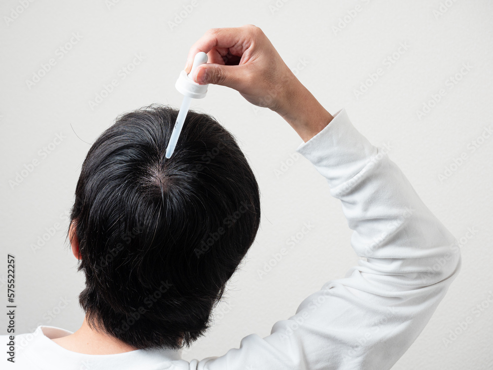 Naklejka premium 育毛剤を塗る男性 後頭部 髪の毛
