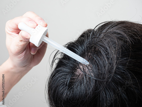 育毛剤を塗る男性　つむじ　髪の毛