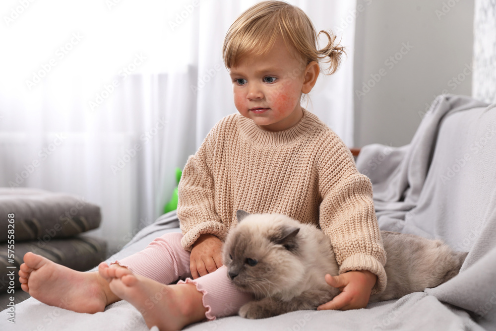 Cute little child with allergic redness sitting with adorable pet on sofa at home Cute little child with allergic redness sitting with adorable pet on sofa at home