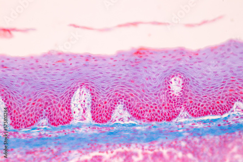 Adipose tissue human, Soft palate human, Bone human and Striated (skeletal) muscle human under the microscope in Lab.
