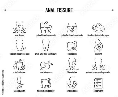 Anal Fissure symptoms, diagnostic and treatment vector icon set. Line editable medical icons.