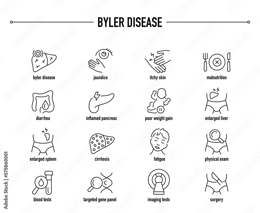 Byler Disease Syndrome symptoms, diagnostic and treatment vector icon ...