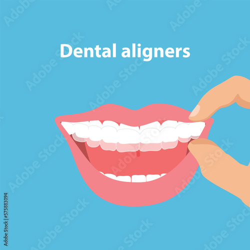 Alignment of teeth by aligners. Orthodontic dentistry concept