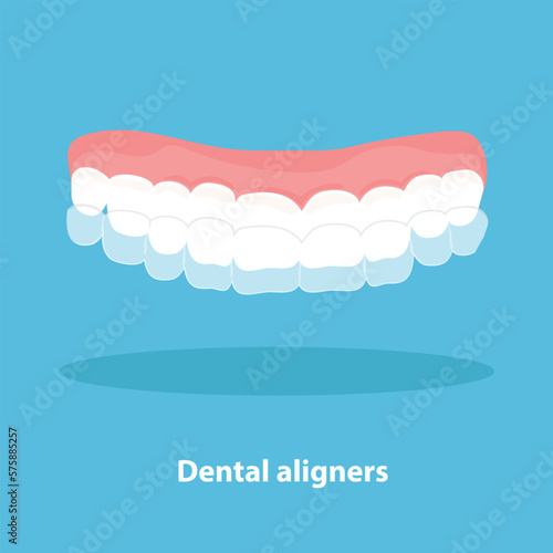 Alignment of teeth by aligners. Orthodontic dentistry concept