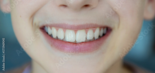 Healthy smile of a teenage girl. Beautiful and even teeth close-up. Dental and gum health