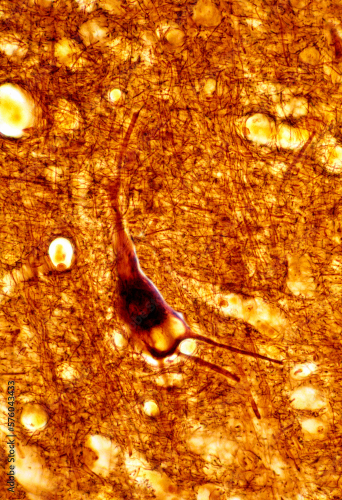 Human cerebral cortex. Pyramidal neuron. Lipofuscin Stock Photo | Adobe ...