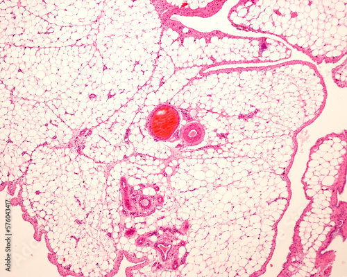 White adipose tissue or fat photo