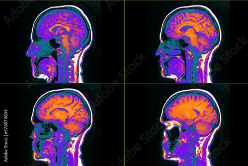 MRI of the brain. Medical image for the study of internal organs and tissues.