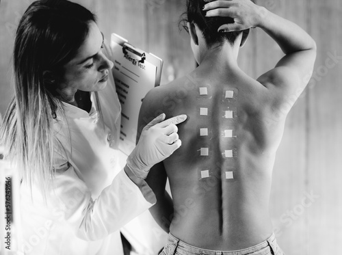 Doctor Doing Skin Allergy Test photo