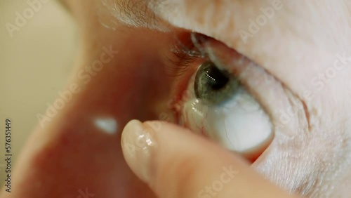 Putting contact lens on eyes . Myopia ophthalmology nearsightedness photo