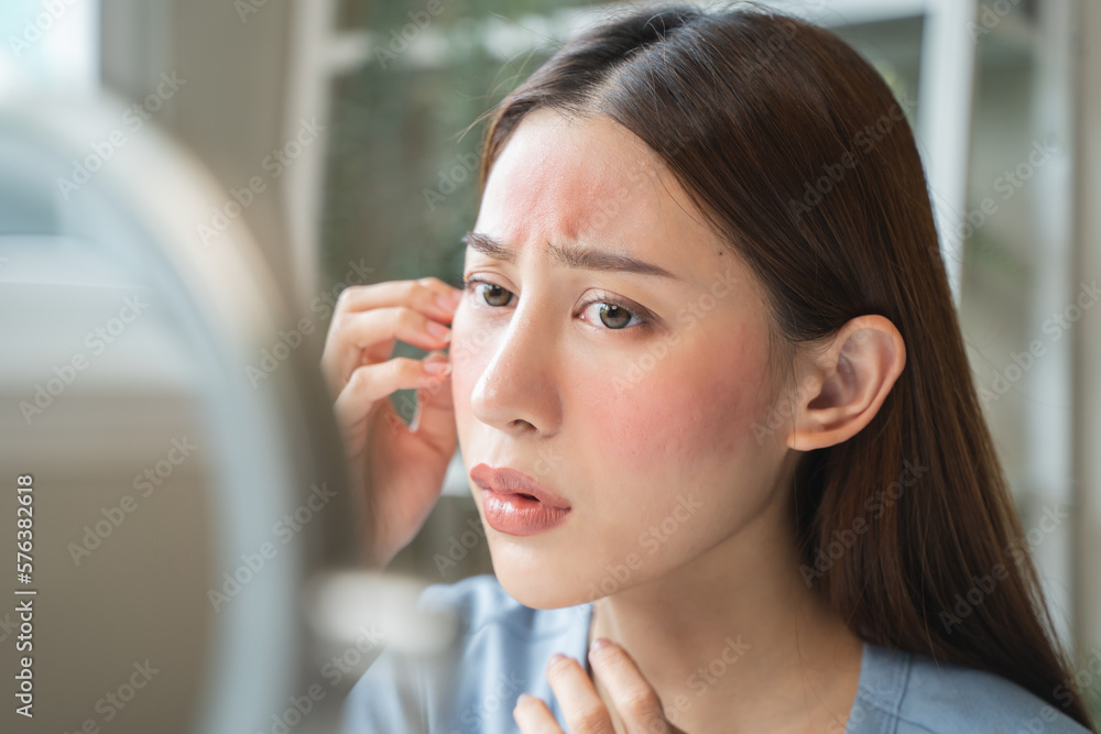 Sensitive skin with cosmetology, Asian young woman looking at red spot ...
