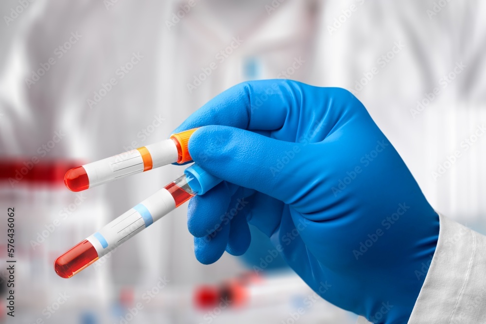 Hand with blood test tube for sample Hand with blood test tube for sample