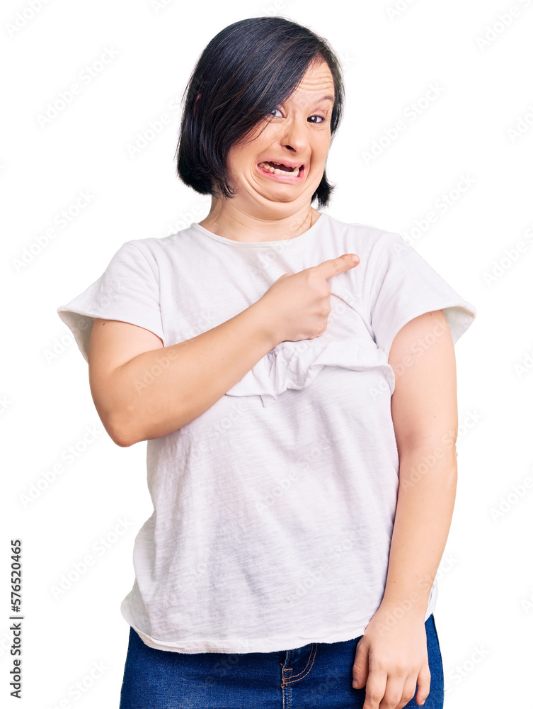 Brunette woman with down syndrome wearing casual white tshirt pointing aside worried and nervous with forefinger, concerned and surprised expression Brunette woman with down syndrome wearing casual white tshirt pointing aside worried and nervous with forefinger, concerned and surprised expression