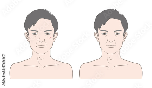 40代から50代くらいの男性の顔の老化、変化、ビフォーアフターのイメージイラスト