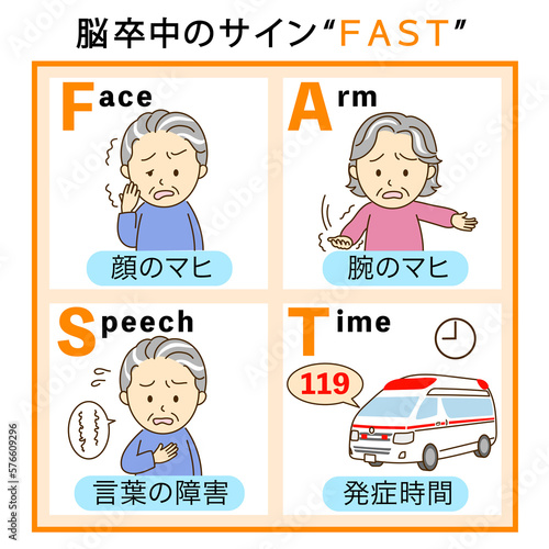 脳卒中チェックFASTの説明イラスト２