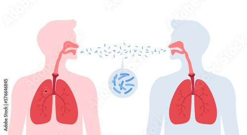 Tuberculosis disease concept. Vector flat healthcare illustration. People silhouette with lung infect other by tb isolated on white background. Design element for health care, education, pulmonology photo