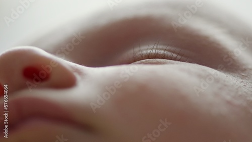 Macro shot of a sleeping childs face affected by diathesis. Troubled face skin of a small Caucasian baby.   Cinematic footage of childs face with skin defect. 