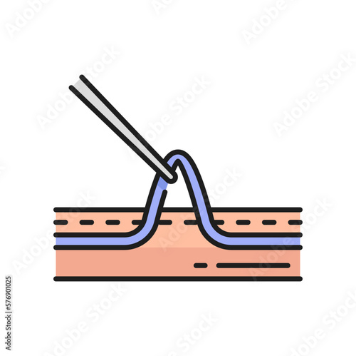 Sclerotherapy surgery, injecting solution in vein through catheter isolated outline icon. Vector varicose and spider veins treatment medical procedure