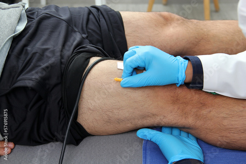 Electromyography EMG and Somatosensory Evoked Potential PEV of lower extremities, neurophysiological test applies electrical stimuli near the nerves to explore the rectus femoris muscle photo